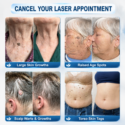 𝐎𝐟𝐟𝐢𝐜𝐢𝐚𝐥 𝐁𝐫𝐚𝐧𝐝 𝐒𝐭𝐨𝐫𝐞 |✅50%𝐏i𝐜𝐝o® 7-𝐷𝑎𝑦 𝗧𝐚𝐠 & 𝗦𝗽𝐨𝐭 𝐄𝐫𝒂𝒔𝒆𝒓(Zero Pain, Zero 𝐒𝐜𝐚𝒓𝒔 Rollerball)